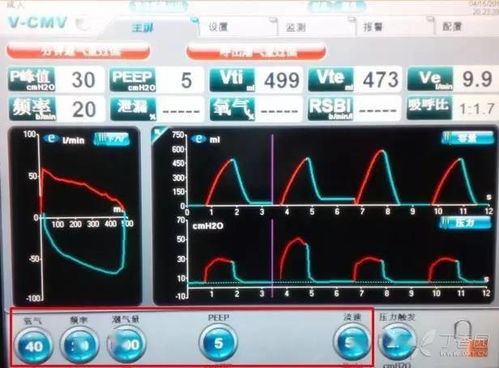 5 種常用呼吸機模式,一文掌握